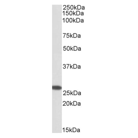 Western Blot - Anti-MIC19 Antibody (A84773) - Antibodies.com