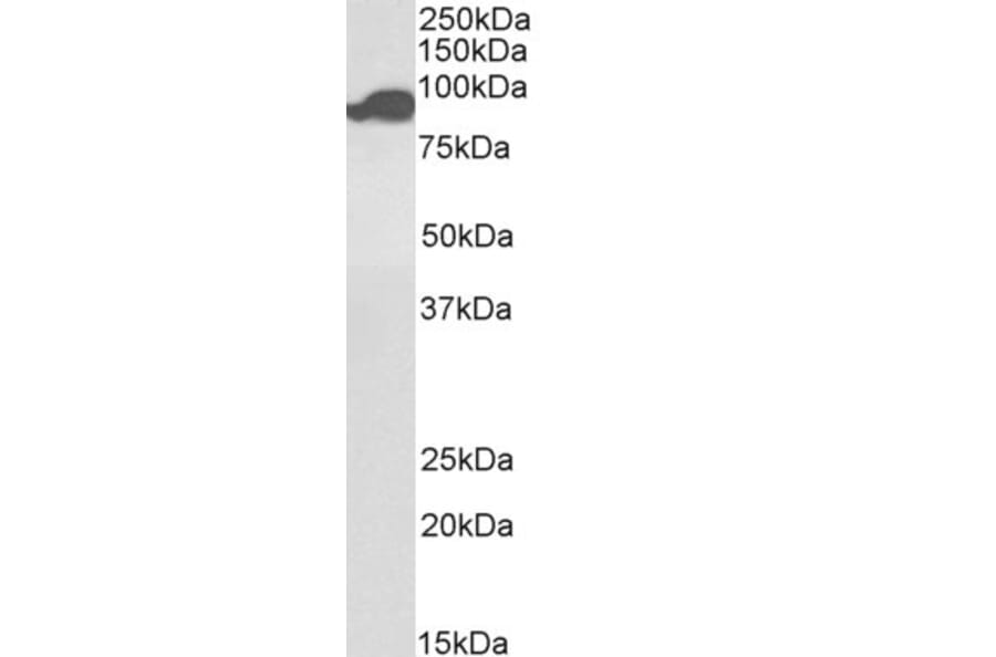 Western Blot - Anti-Aconitase 2 Antibody (Biotin) (A84776) - Antibodies.com