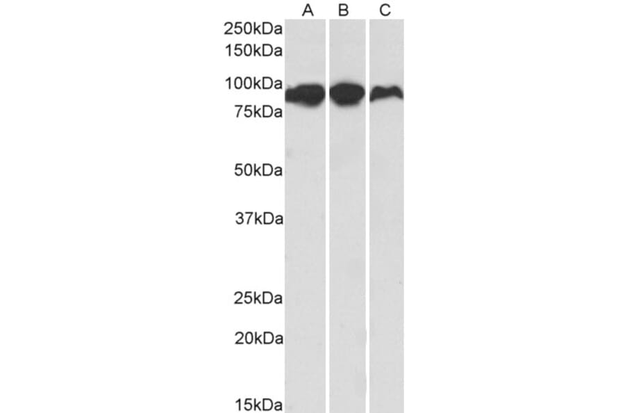 Western Blot - Anti-Aconitase 2 Antibody (A84777) - Antibodies.com