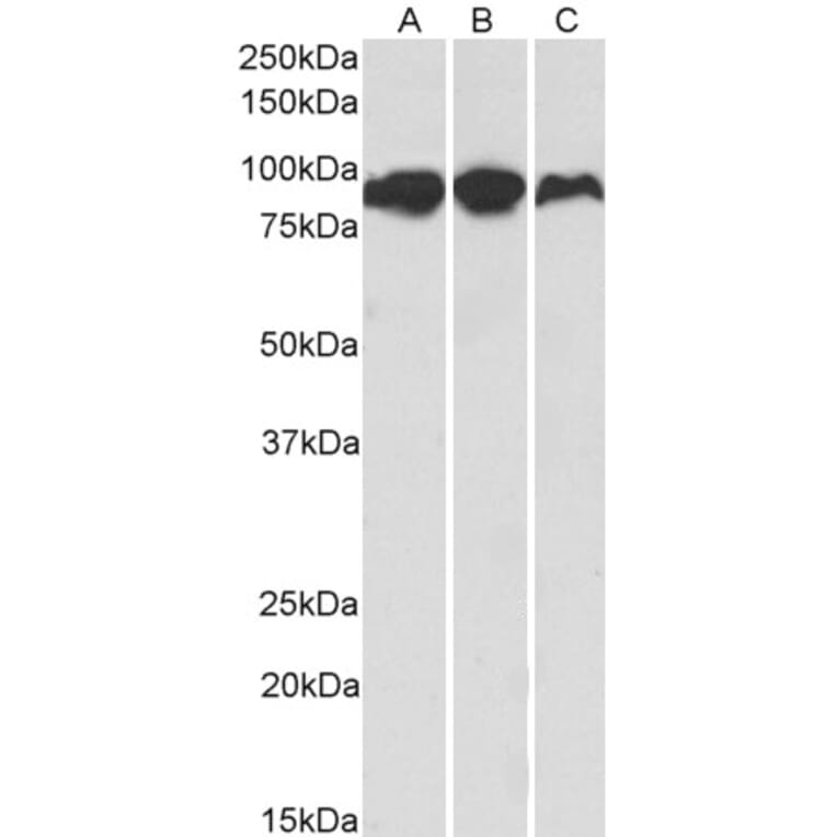 Western Blot - Anti-Aconitase 2 Antibody (A84777) - Antibodies.com