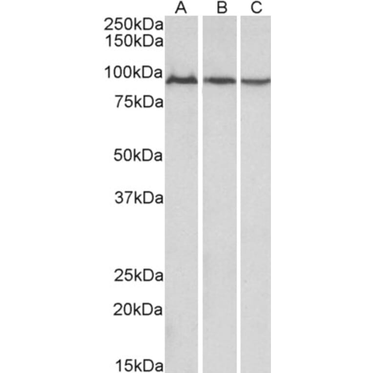 Western Blot - Anti-Aconitase 2 Antibody (A84777) - Antibodies.com