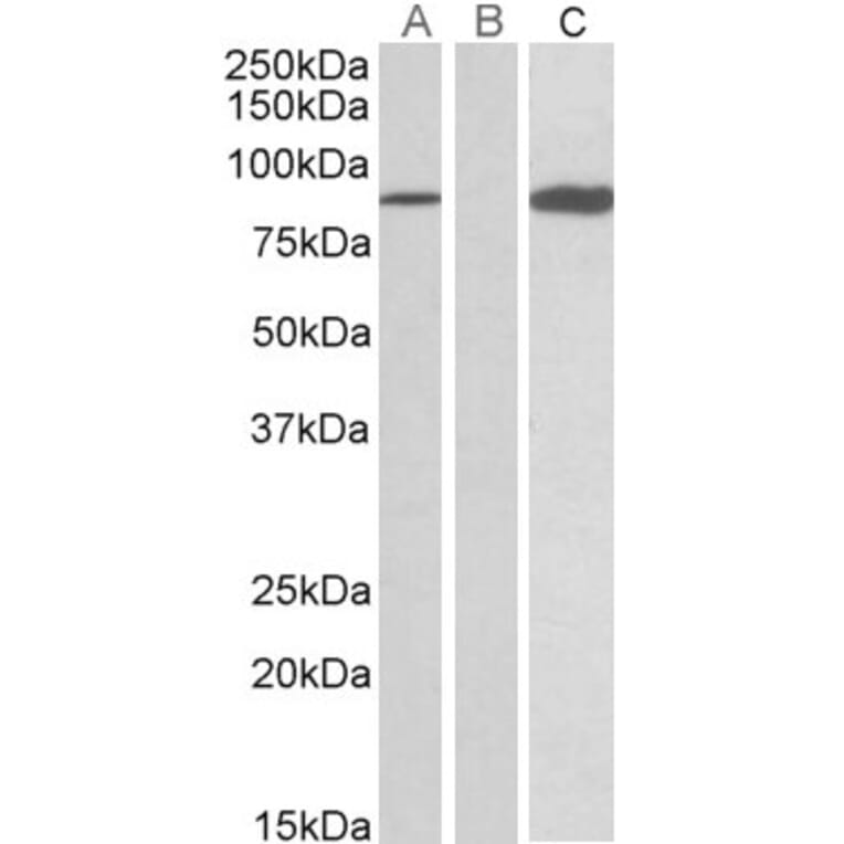 Western Blot - Anti-STAT4 Antibody (A84779) - Antibodies.com