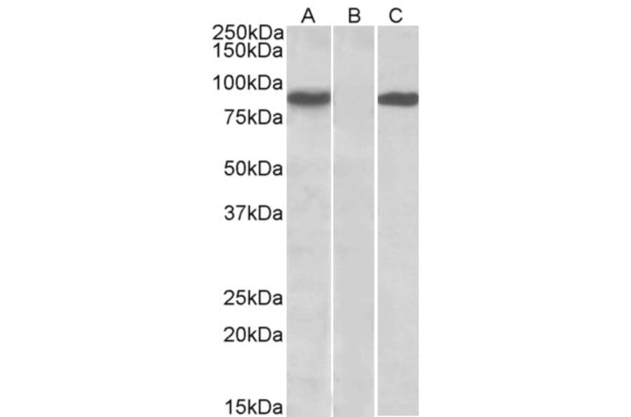 Western Blot - Anti-STAT4 Antibody (A84780) - Antibodies.com