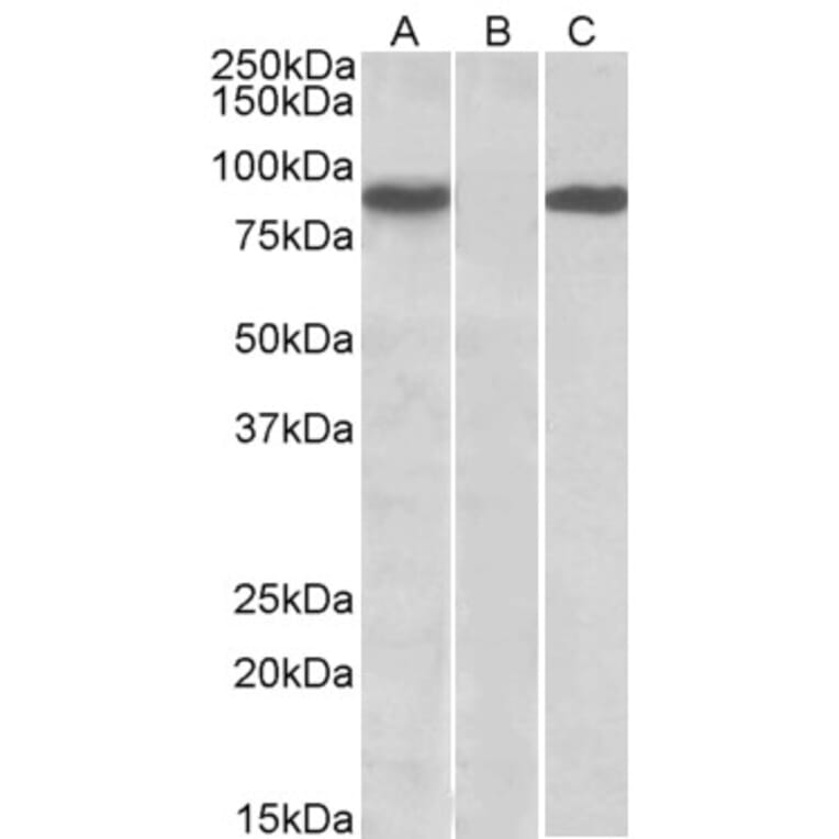 Western Blot - Anti-STAT4 Antibody (A84780) - Antibodies.com