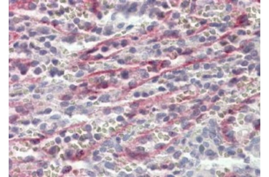 Immunohistochemistry - Anti-Stabilin-1 Antibody (A84781) - Antibodies.com