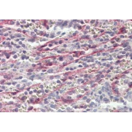 Immunohistochemistry - Anti-Stabilin-1 Antibody (A84781) - Antibodies.com