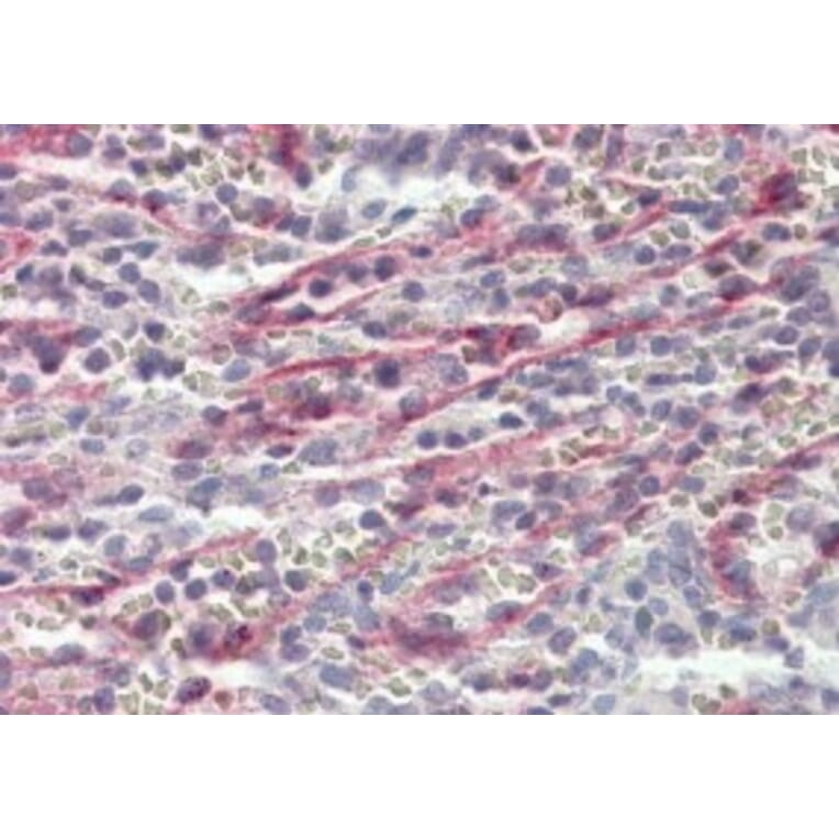 Immunohistochemistry - Anti-Stabilin-1 Antibody (A84781) - Antibodies.com