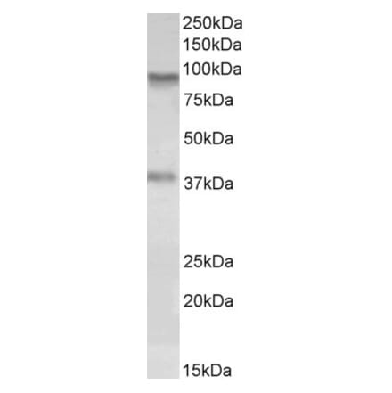 Western Blot - Anti-VAP1 Antibody (A84782) - Antibodies.com