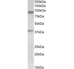 Western Blot - Anti-AOC3 Antibody (A84782) - Antibodies.com