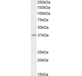 Western Blot - Anti-AIM2 Antibody (A84784) - Antibodies.com