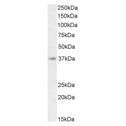 Western Blot - Anti-AIM2 Antibody (A84784) - Antibodies.com