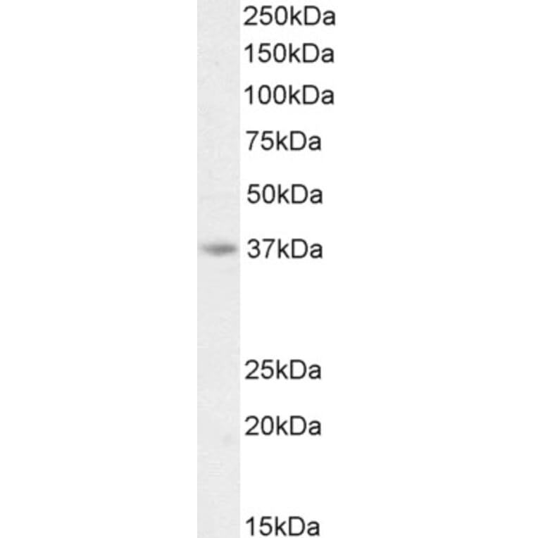 Western Blot - Anti-AIM2 Antibody (A84784) - Antibodies.com