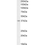 Western Blot - Anti-AIM2 Antibody (A84784) - Antibodies.com