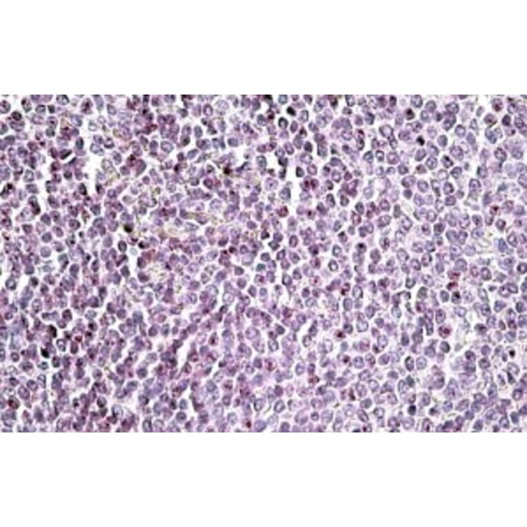 Immunohistochemistry - Anti-AIM2 Antibody (A84784) - Antibodies.com