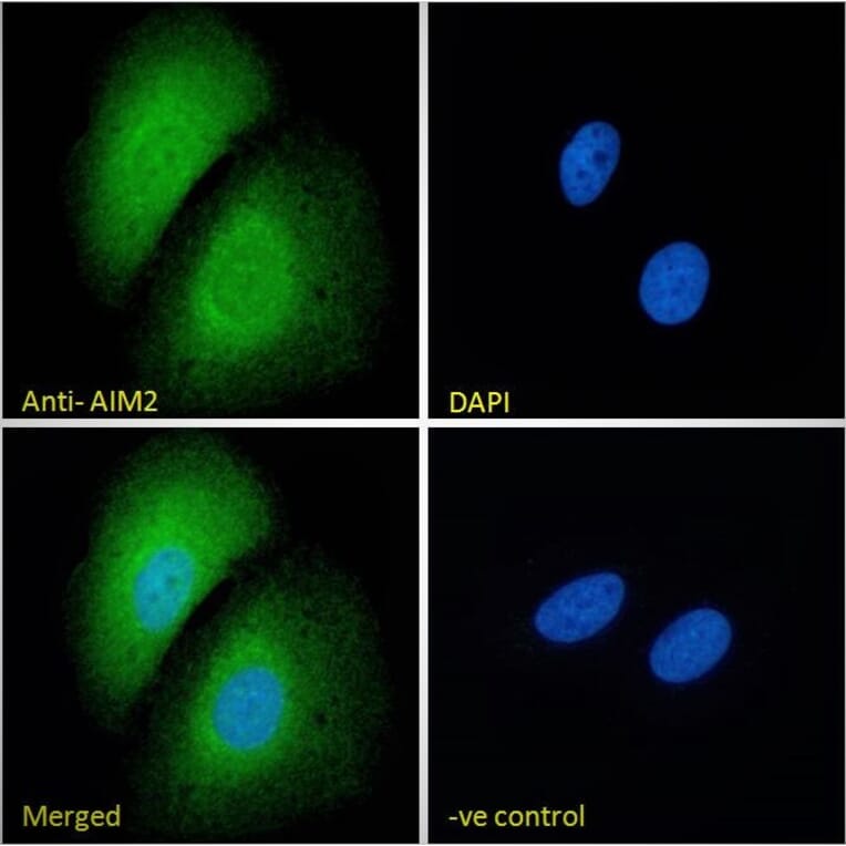 Immunofluorescence - Anti-AIM2 Antibody (A84784) - Antibodies.com