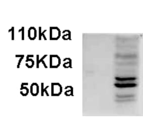 Western Blot - Anti-AIM2 Antibody (A84784) - Antibodies.com