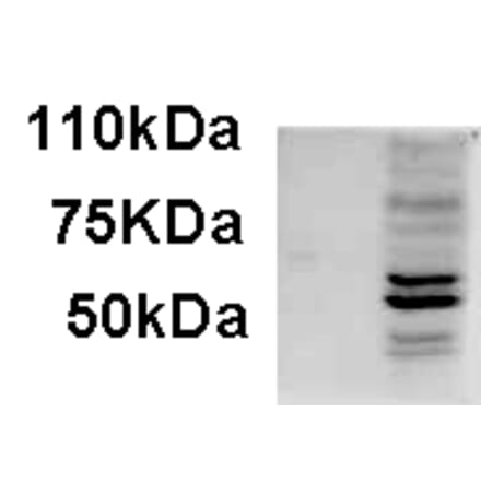 Western Blot - Anti-AIM2 Antibody (A84784) - Antibodies.com