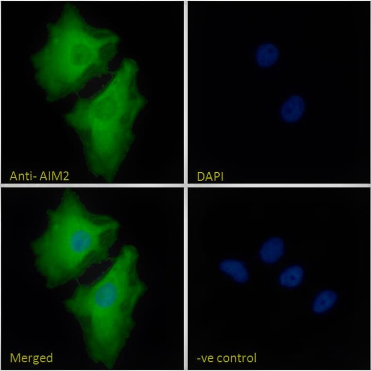 Immunofluorescence - Anti-AIM2 Antibody (A84784) - Antibodies.com