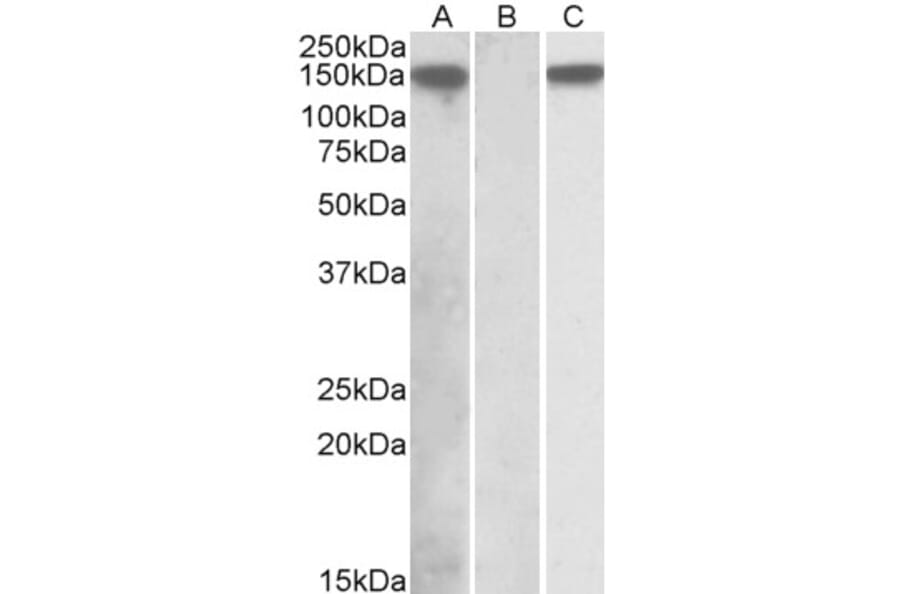 Western Blot - Anti-NALP2 Antibody (A84785) - Antibodies.com