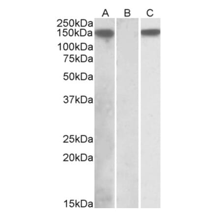 Western Blot - Anti-NALP2 Antibody (A84785) - Antibodies.com