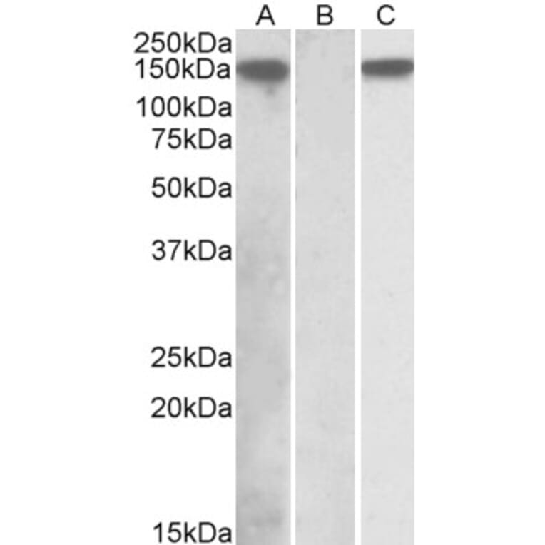 Western Blot - Anti-NALP2 Antibody (A84785) - Antibodies.com