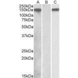 Western Blot - Anti-NALP2 Antibody (A84785) - Antibodies.com
