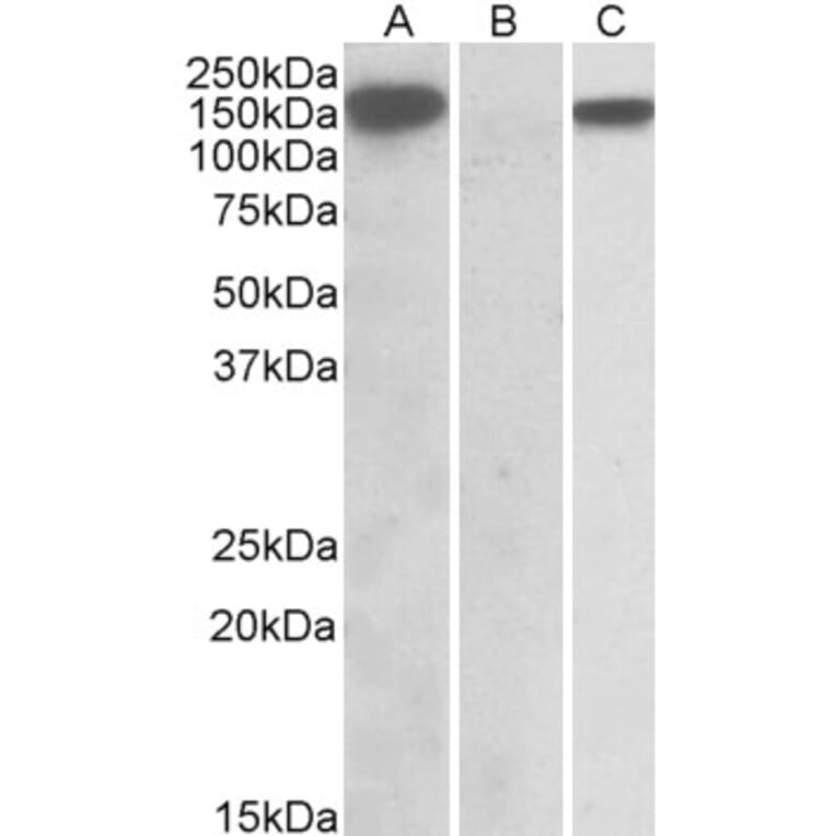 Western Blot - Anti-NALP2 Antibody (A84786) - Antibodies.com