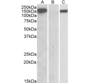 Western Blot - Anti-NLRP2 Antibody (A84786) - Antibodies.com