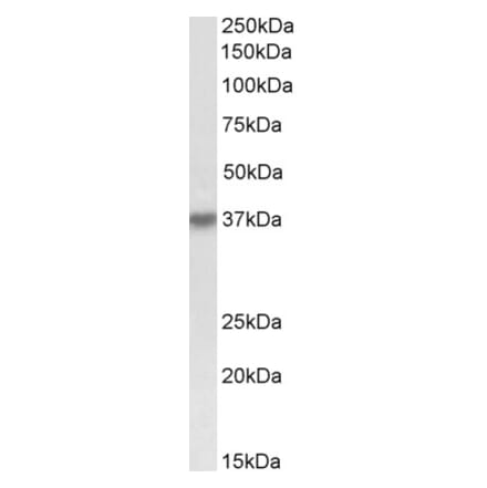 Western Blot - Anti-HSH2D Antibody (A84788) - Antibodies.com