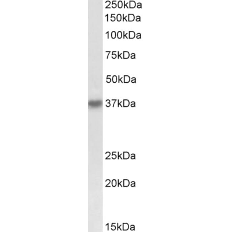 Western Blot - Anti-HSH2D Antibody (A84788) - Antibodies.com