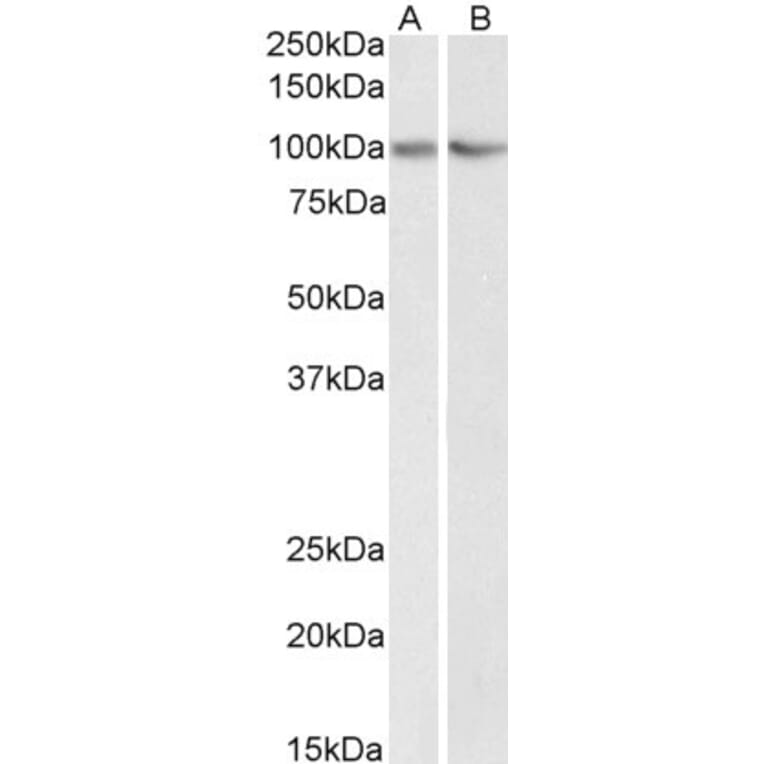 Western Blot - Anti-TRIM71/LIN41 Antibody (A84789) - Antibodies.com