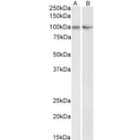 Western Blot - Anti-TRIM71/LIN41 Antibody (A84789) - Antibodies.com
