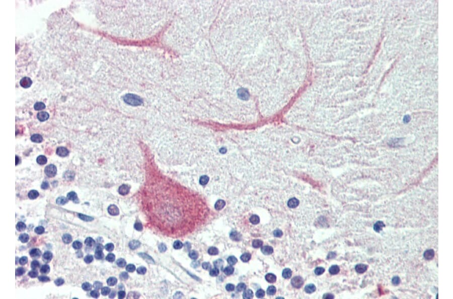 Immunohistochemistry - Anti-TRIM71/LIN41 Antibody (A84789) - Antibodies.com
