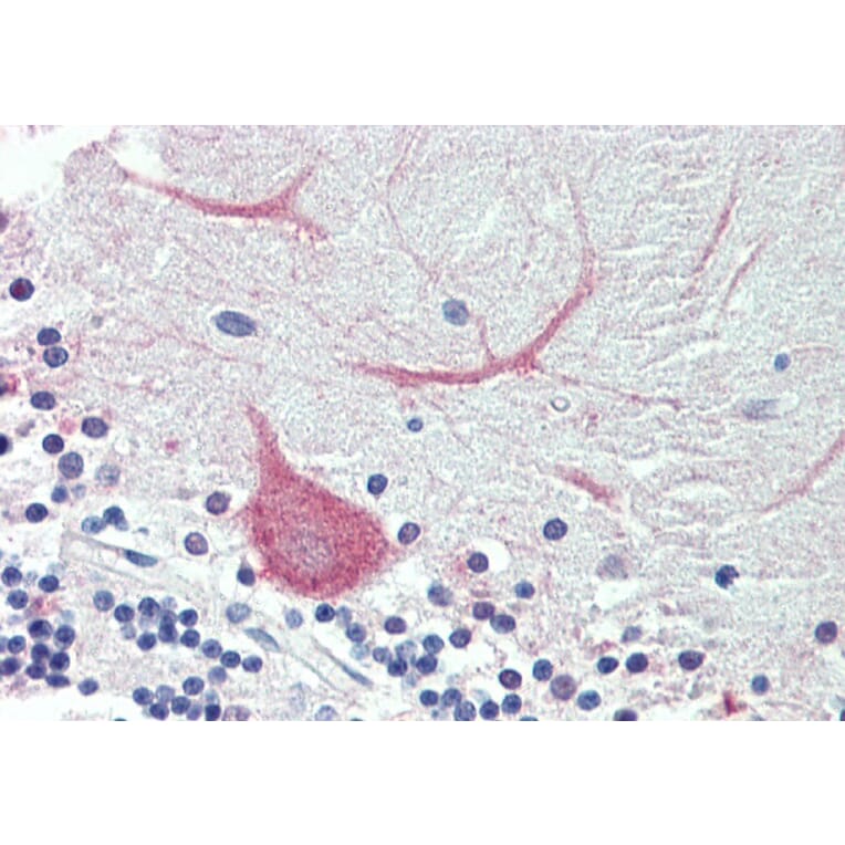 Immunohistochemistry - Anti-TRIM71/LIN41 Antibody (A84789) - Antibodies.com
