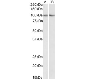 Western Blot - Anti-TRIM71 Antibody (A84789) - Antibodies.com