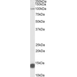 Western Blot - Anti-TRIM71/LIN41 Antibody (A84790) - Antibodies.com
