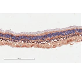 Immunohistochemistry - Anti-ARMS2 Antibody (A84791) - Antibodies.com