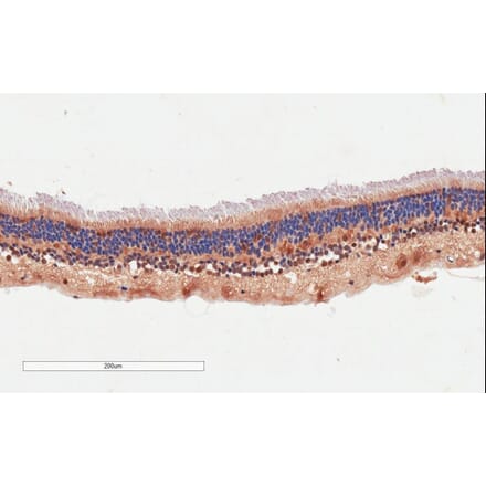 Immunohistochemistry - Anti-ARMS2 Antibody (A84791) - Antibodies.com