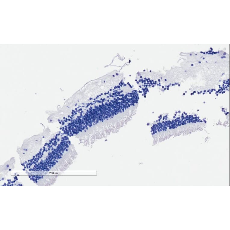 Immunohistochemistry - Anti-ARMS2 Antibody (A84791) - Antibodies.com