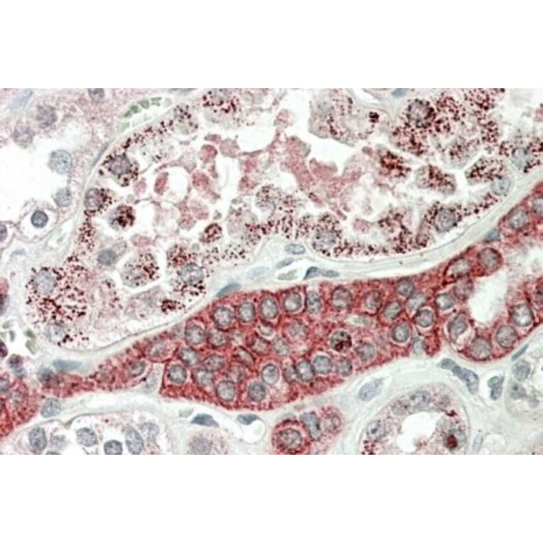 Immunohistochemistry - Anti-DCUN1D1 Antibody (A84792) - Antibodies.com