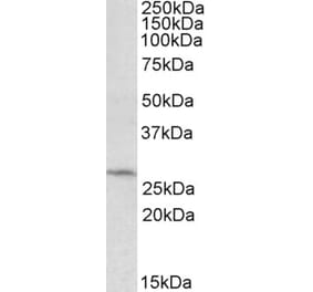 Western Blot - Anti-DCUN1D1 Antibody (A84792) - Antibodies.com