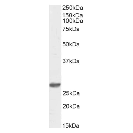 Western Blot - Anti-DCUN1D1 Antibody (Biotin) (A84793) - Antibodies.com