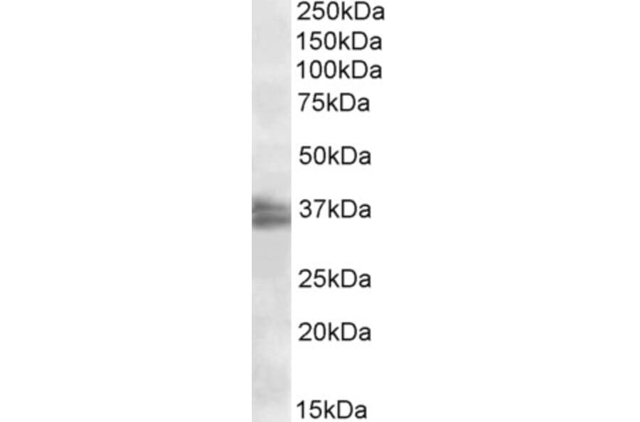 Western Blot - Anti-FRG1 Antibody (A84796) - Antibodies.com