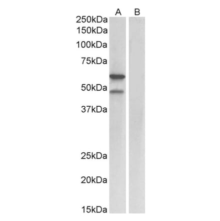 Western Blot - Anti-E2F3 Antibody (A84797) - Antibodies.com