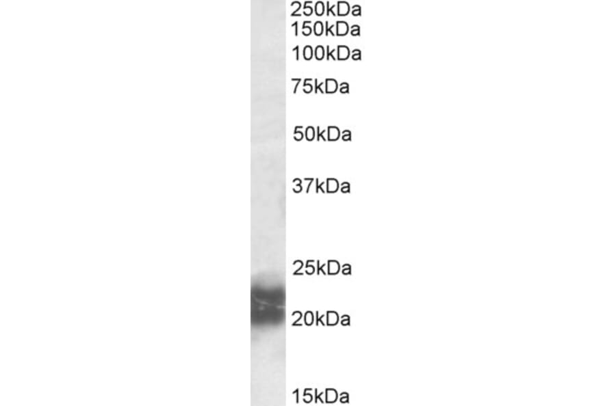 Western Blot - Anti-Niemann Pick C2 Antibody (A84800) - Antibodies.com