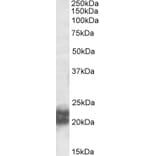 Western Blot - Anti-Niemann Pick C2 Antibody (A84800) - Antibodies.com