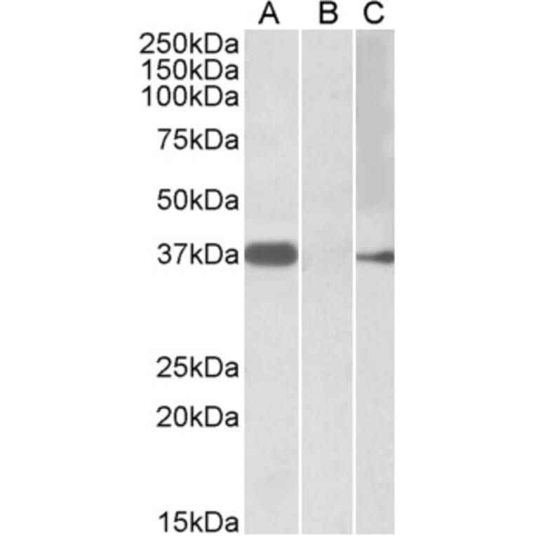 Western Blot - Anti-MYF6 Antibody (A84803) - Antibodies.com