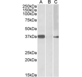 Western Blot - Anti-MYF6 Antibody (A84803) - Antibodies.com