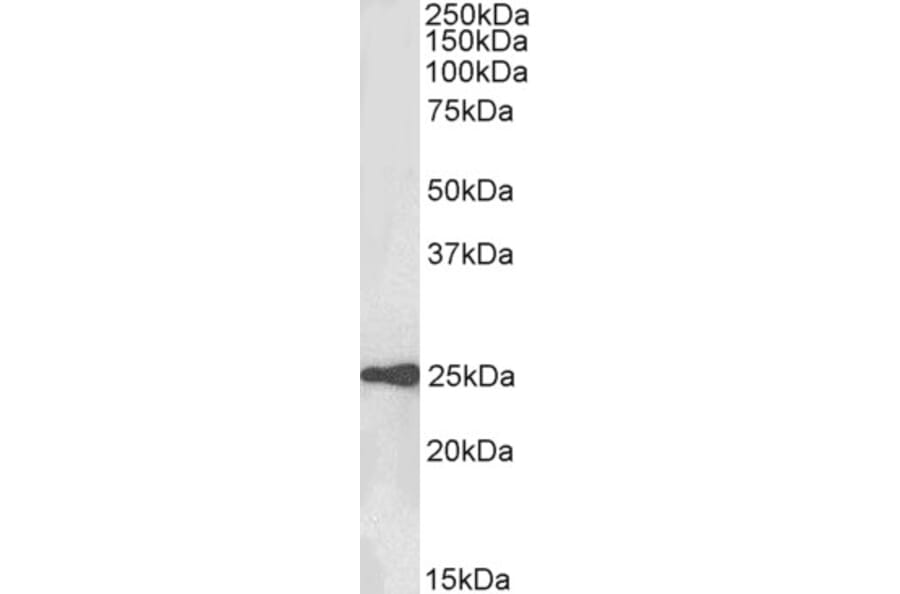 Western Blot - Anti-HE4 Antibody (A84804) - Antibodies.com
