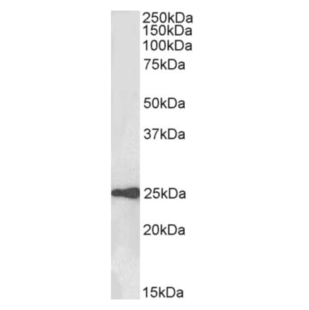 Western Blot - Anti-HE4 Antibody (A84804) - Antibodies.com